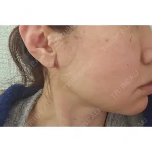 EMMO FACE CLINIC EMMO FACE CLINIC 東京三田院口コミ