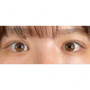 口コミ