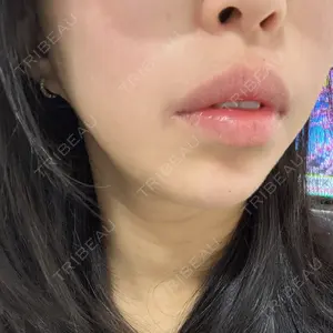 口コミ
