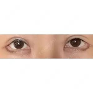 HAAB×DREAM BEAUTY CLINIC HAAB×DREAM BEAUTY CLINIC 大阪梅田院口コミ