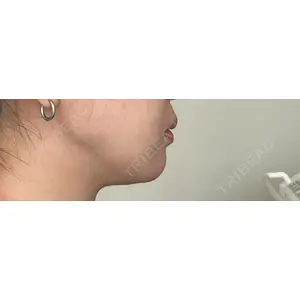 ルラ美容クリニック ルラ美容クリニック 池袋院口コミ