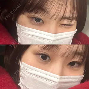 口コミ