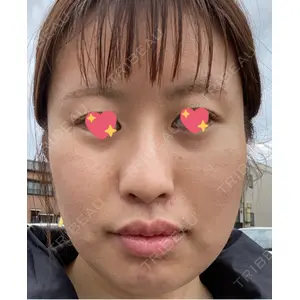 口コミ