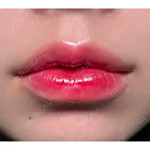 R Beauty CLINIC R Beauty CLINIC 銀座院口コミ