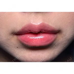 R Beauty CLINIC R Beauty CLINIC 銀座院口コミ