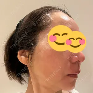 X CLINIC X CLINIC 銀座院口コミ
