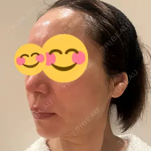 X CLINIC X CLINIC 銀座院口コミ