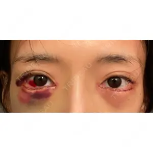 東京シンデレラ美容外科 東京シンデレラ美容外科 池袋院口コミ