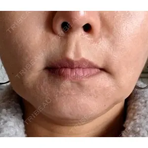 NARU Beauty Clinic NARU Beauty Clinic 【ナルクリ】口コミ