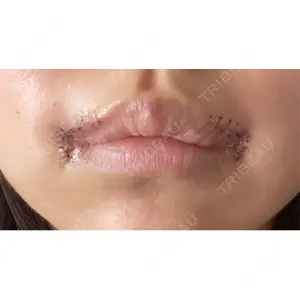 R Beauty CLINIC R Beauty CLINIC 銀座院口コミ