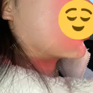 TCB東京中央美容外科 TCB東京中央美容外科 宇都宮院口コミ