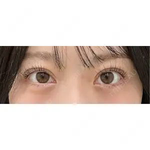 東京シンデレラ美容外科 東京シンデレラ美容外科 池袋院口コミ