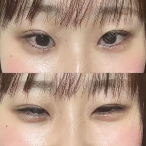 口コミ