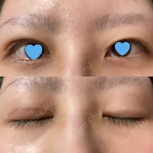 いちのせ形成外科・皮膚科 眼瞼＆フェイスクリニック口コミ