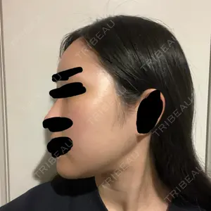 セギム美容整形外科口コミ