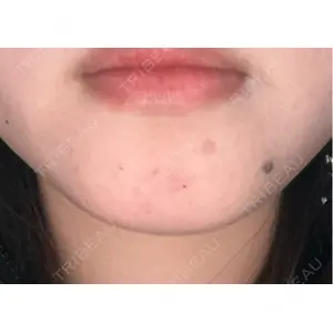 ルラ美容クリニック ルラ美容クリニック 池袋院口コミ