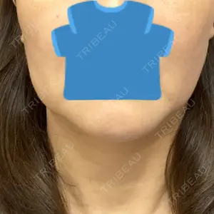 TCB東京中央美容外科 TCB東京中央美容外科 立川院口コミ