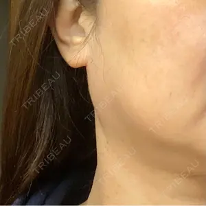 TCB東京中央美容外科 TCB東京中央美容外科 立川院口コミ