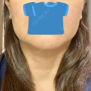 TCB東京中央美容外科 TCB東京中央美容外科 立川院口コミ