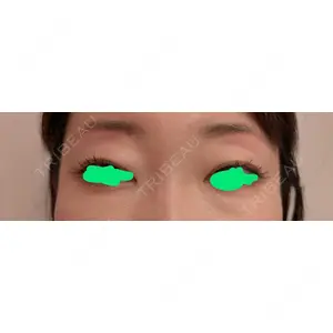 口コミ