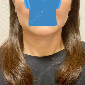 TCB東京中央美容外科 TCB東京中央美容外科 立川院口コミ