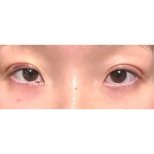 湘南美容クリニック 湘南美容クリニック 千葉センシティ院口コミ
