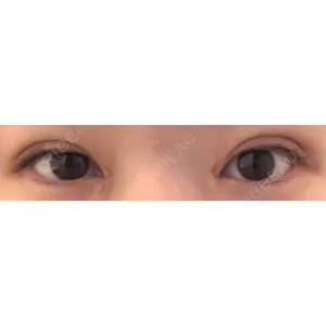 東京シンデレラ美容外科 東京シンデレラ美容外科 池袋院口コミ