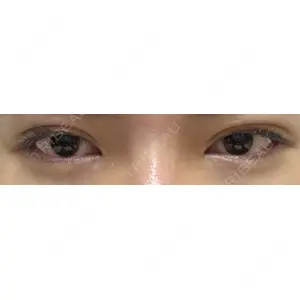 口コミ