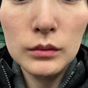 DMTC美容皮膚科 DMTC美容皮膚科 日本橋院口コミ