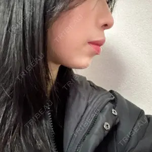 口コミ