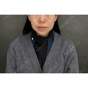 Nebula Clinic ネビュラクリニック 京都院口コミ