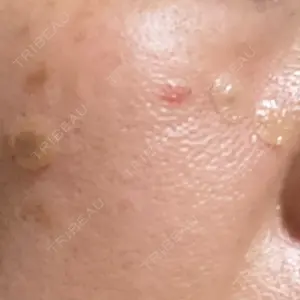 Fellez Clinic【フェルズクリニック】口コミ