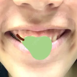 銀座マイアミ美容外科の