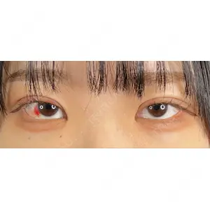 藤・ナチュレ美容クリニック 藤・ナチュレ美容クリニック 銀座院口コミ