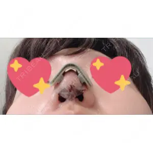 口コミ