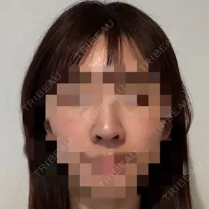 口コミ
