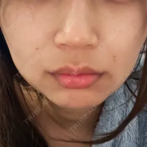 口コミ