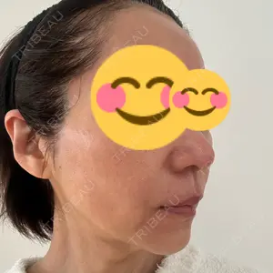 X CLINIC X CLINIC 銀座院口コミ