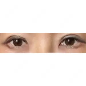 HAAB×DREAM BEAUTY CLINIC HAAB×DREAM BEAUTY CLINIC 大阪梅田院口コミ