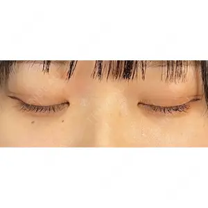 藤・ナチュレ美容クリニック 藤・ナチュレ美容クリニック 銀座院口コミ