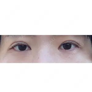 東京イセアクリニック口コミ