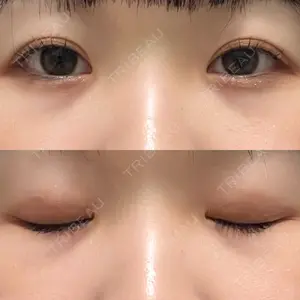 口コミ