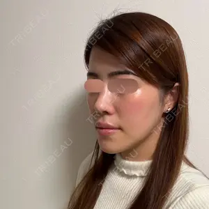 セギム美容整形外科口コミ