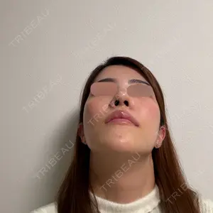 セギム美容整形外科口コミ