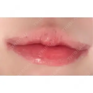 R Beauty CLINIC R Beauty CLINIC 銀座院口コミ