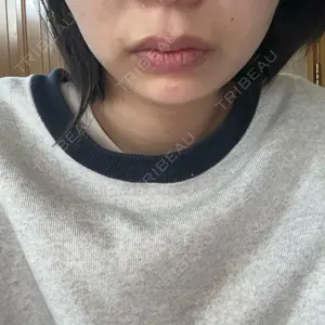 口コミ