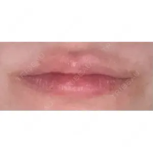口コミ