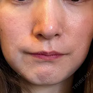 DMTC美容皮膚科 DMTC美容皮膚科 日本橋院口コミ
