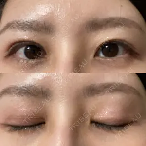 いちのせ形成外科・皮膚科 眼瞼＆フェイスクリニック口コミ