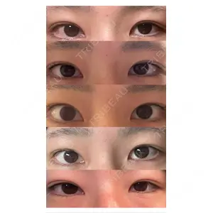 プロミス整形外科口コミ